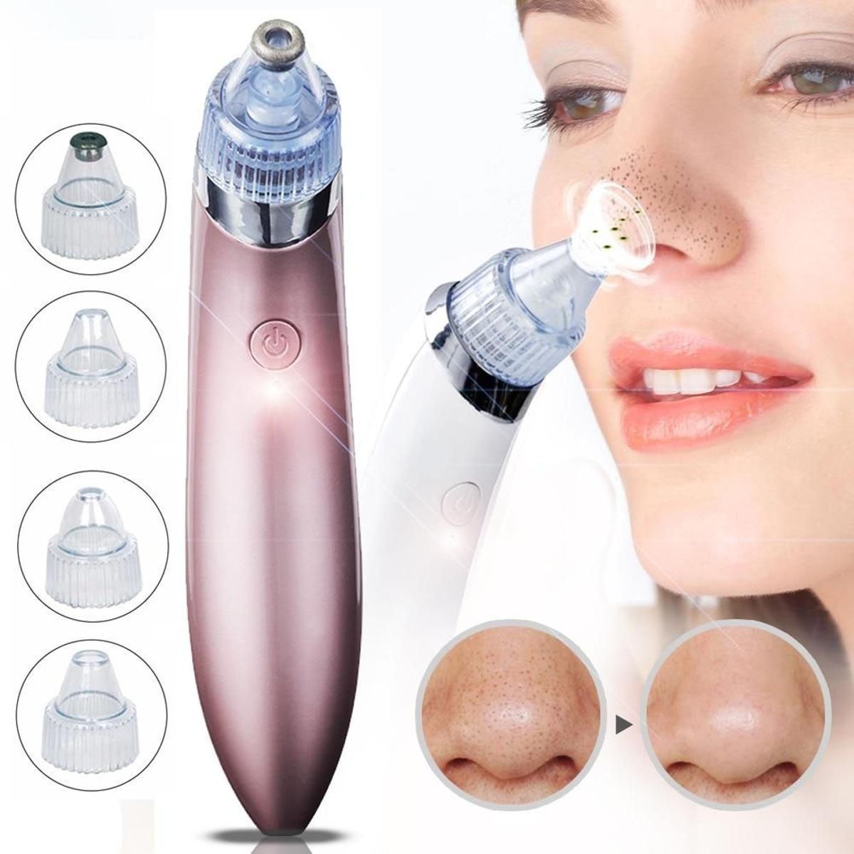 Blackhead Removal Machine | Acne Pimple Pore Cleaner Vacuum Suction Tool
