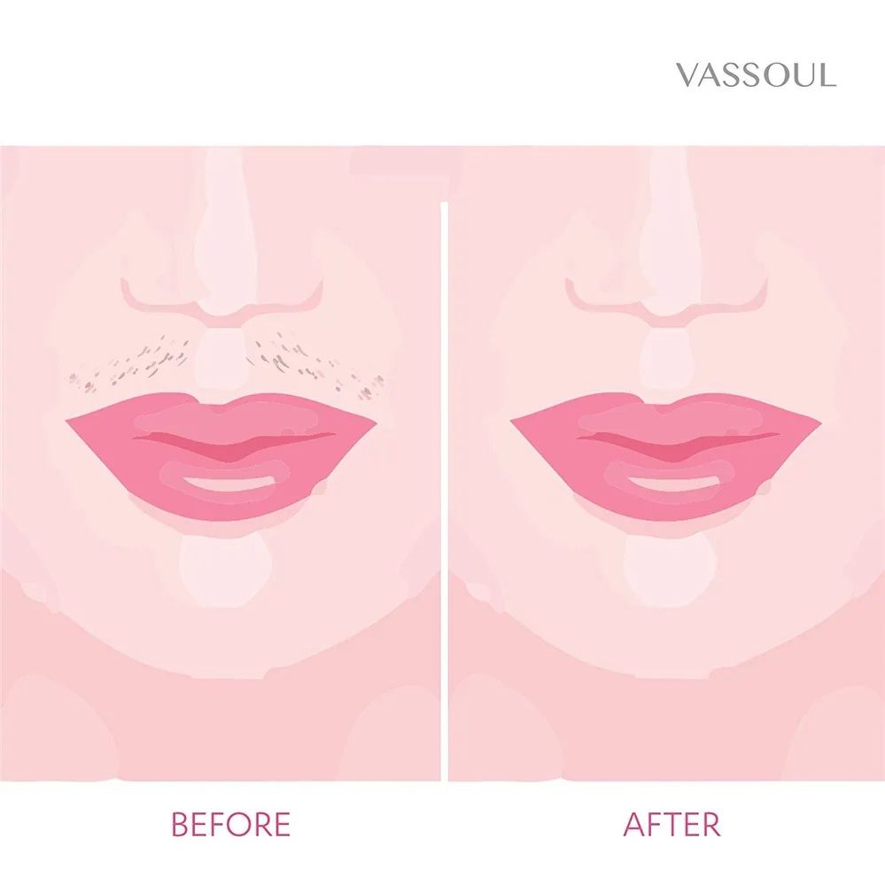 Cell Operated Flawless Women Painless Hair Remover Face Facial Hair Remover - Image 4